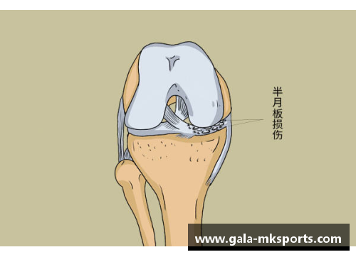MK体育足球星辰的韧性之旅 半月板损伤如何改变了他们的职业生涯